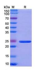 SDS-PAGE (SMO-6317H).jpg